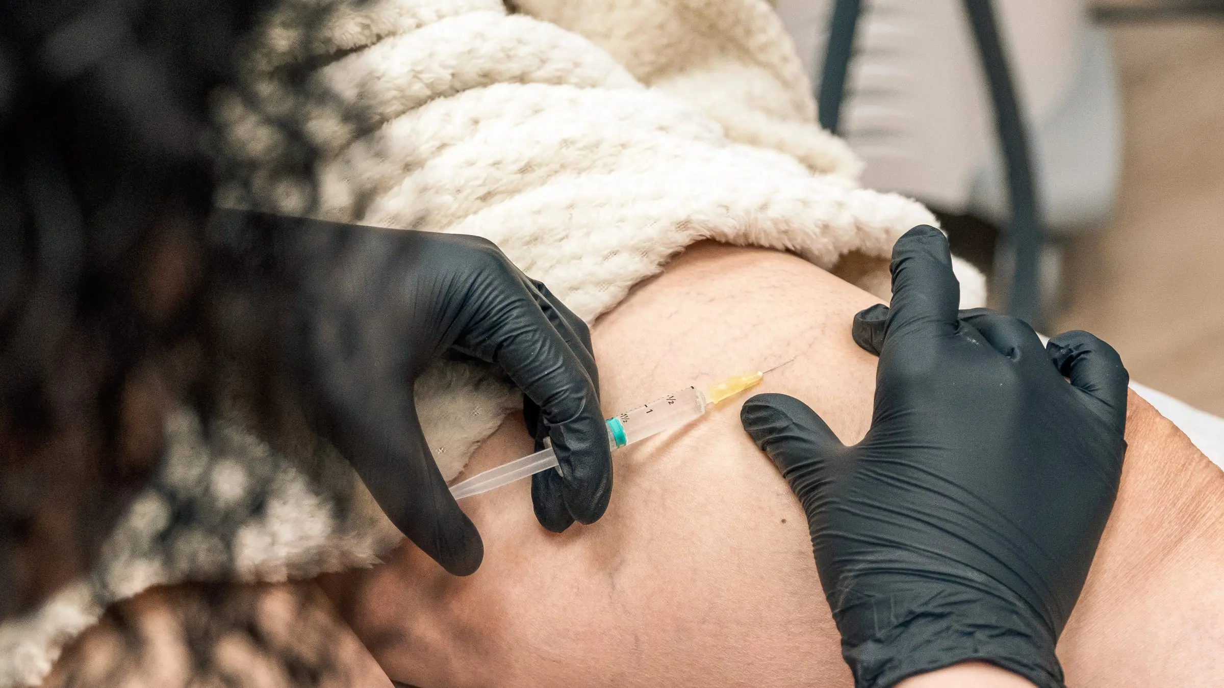 Behandler med handsker behandler kar på benet med en tynd nål